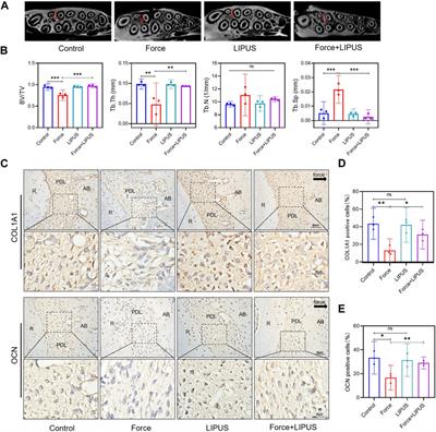 Low-intensity pulsed ultrasound promotes the osteogenesis of mechanical force-treated periodontal ligament cells via Piezo1